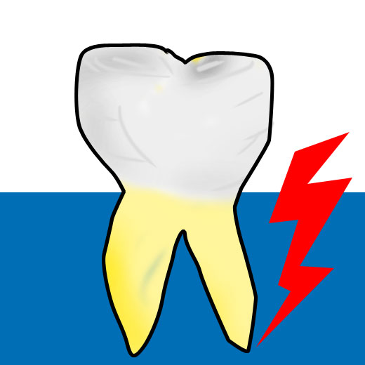 tmd-dentalmedical - pour stopper le bruxisme