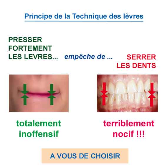 TechnLevres pincement de lèvres contre le serrement de dents